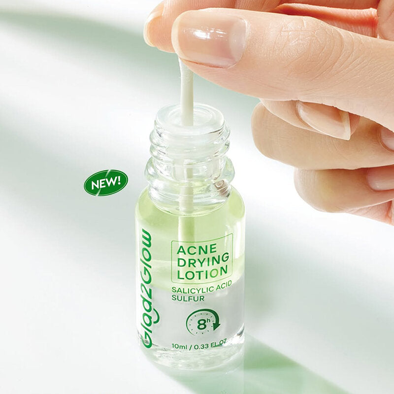 Glad2Glow Acne Drying Lotion - 10ml for Acne-Prone Skin - Beauty Buddy