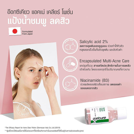 Oxe Cure Acne Clear Potion - 15ml Acne Treatment Liquid - Beauty Buddy