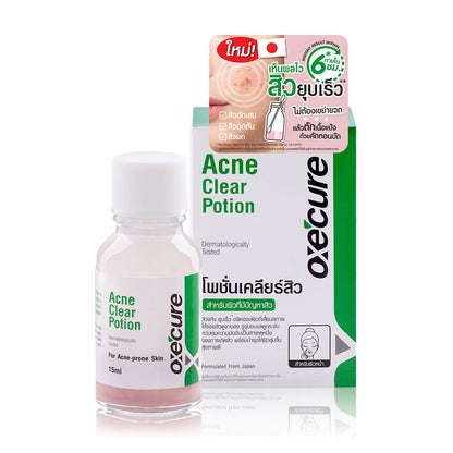 Oxe Cure Acne Clear Potion - 15ml Acne Treatment Liquid - Beauty Buddy