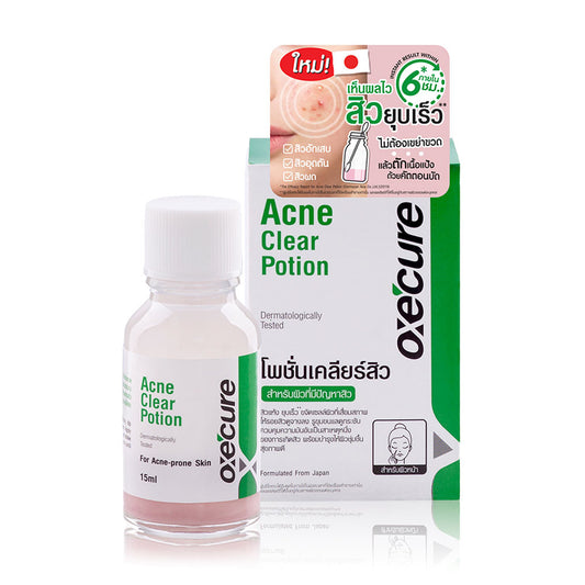Oxe Cure Acne Clear Potion - 15ml Acne Treatment Liquid