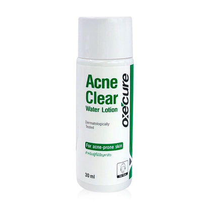 Oxe Cure Acne Clear Lotion - 30ml for Acne-Prone Skin - Beauty Buddy