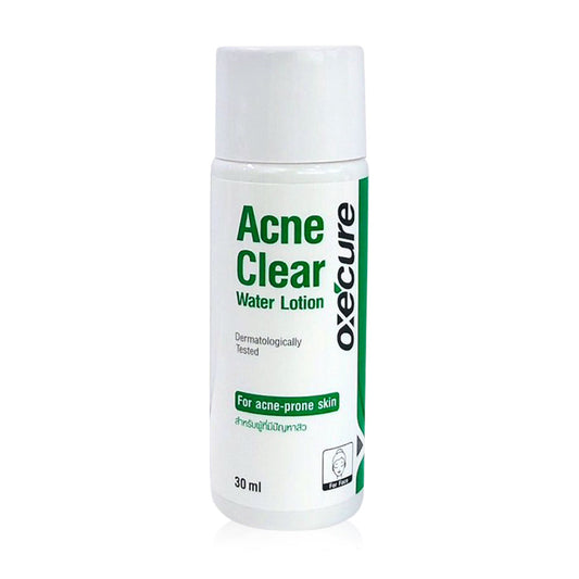 Oxe Cure Acne Clear Lotion - 30ml for Acne-Prone Skin - Beauty Buddy