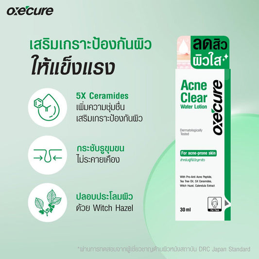 Oxe Cure Acne Clear Lotion - 30ml for Acne-Prone Skin - Beauty Buddy