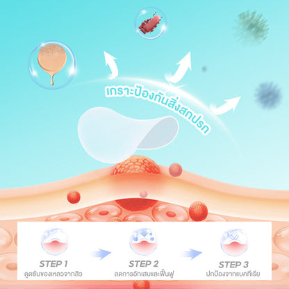 Oni Star Acne Patch 36 Dots Hydrocolloid