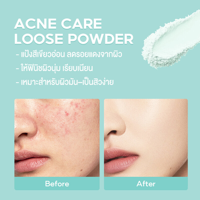 Oni Acne Care Loose Powder 50g