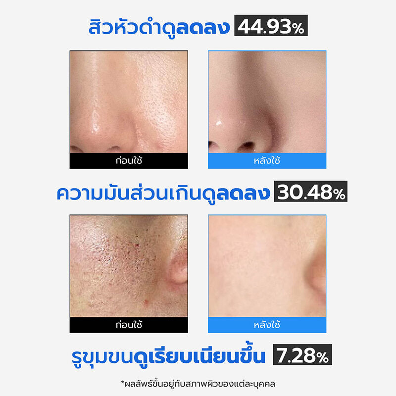 MEDICUBE Zero Pore Pad 2.0 155g [70 Pads]
