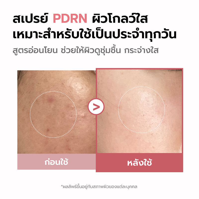 MEDICUBE PDRN Pink Glutathione Serum Mist 100ml