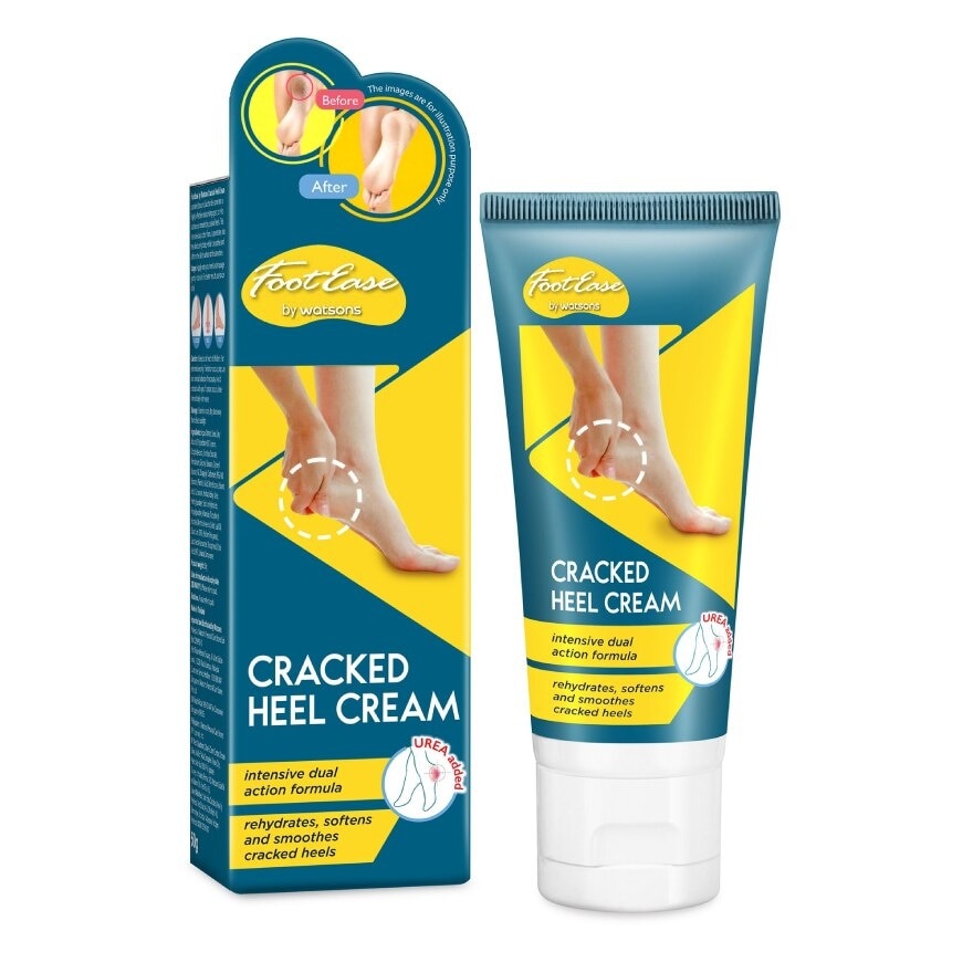 Watsons Foot Ease by Watosns Cracked Heel Cream 50g